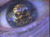 Dryaditis, a fatal ocular condition.